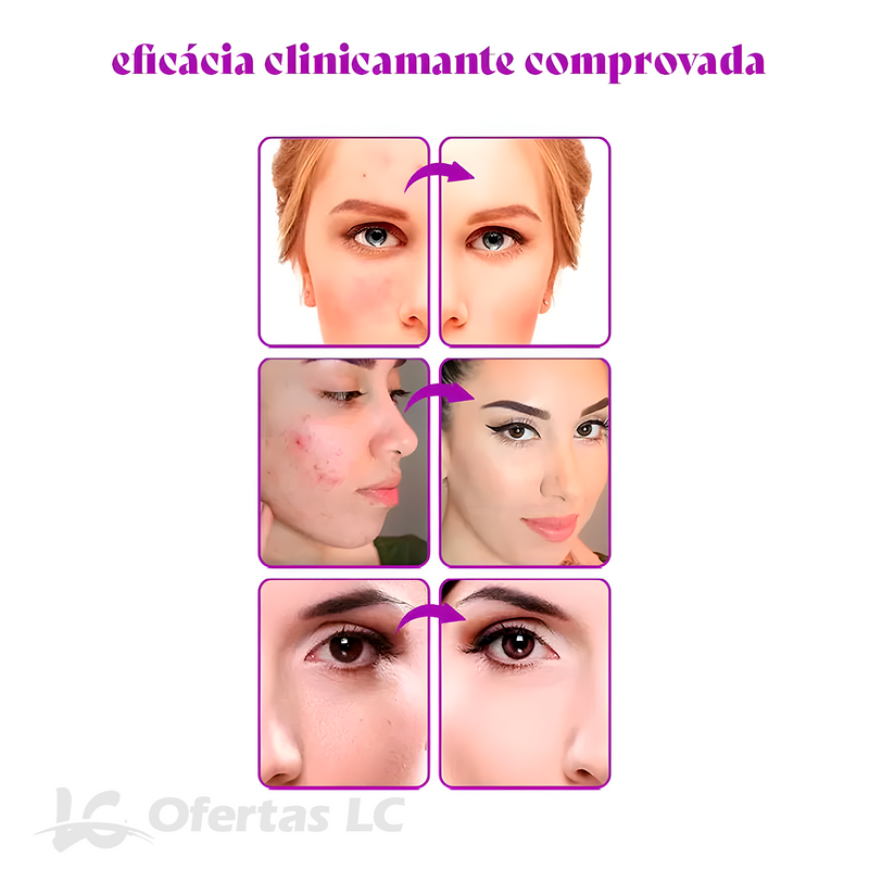 Base TLM Foundation 4 em 1 - Camufla Manchas e Marcas