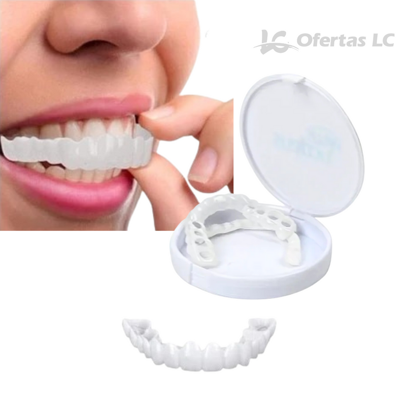 Facetas Odontológicas Removíveis - SmileFit - Cobre falhas, Quebras e Manchas