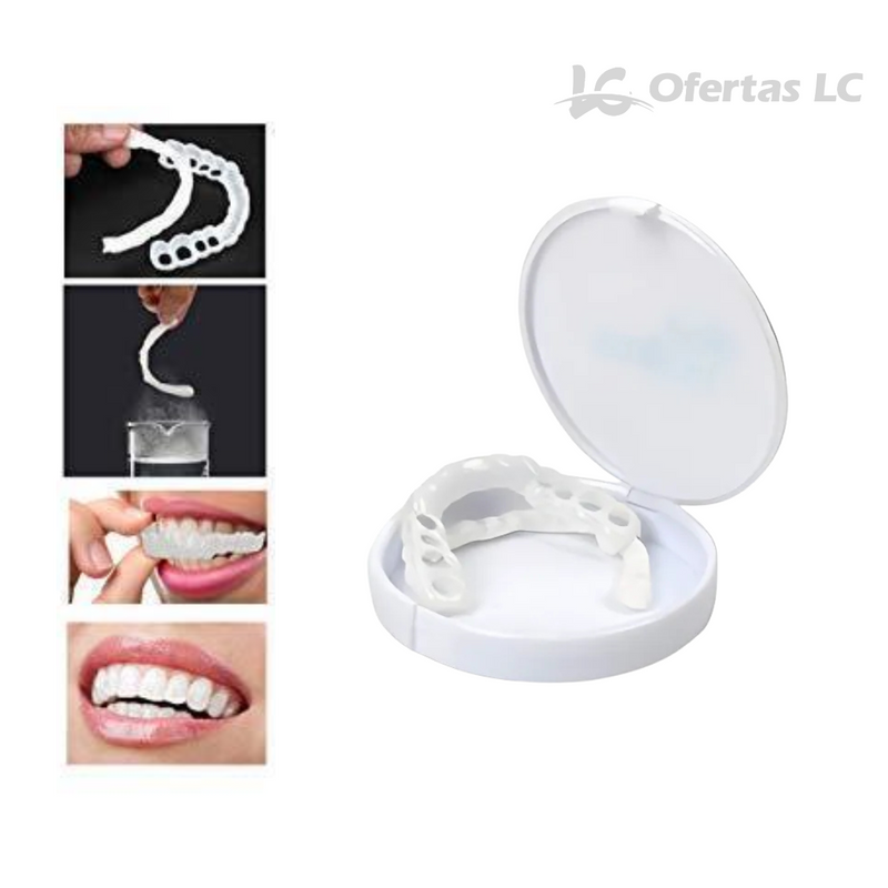 Facetas Odontológicas Removíveis - SmileFit - Cobre falhas, Quebras e Manchas